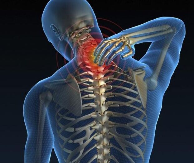 Osteochondroza szyjka macicy